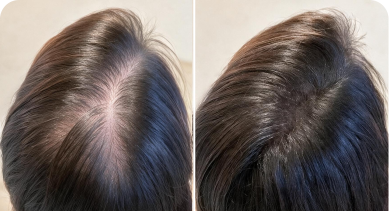 Customer before and after comparison